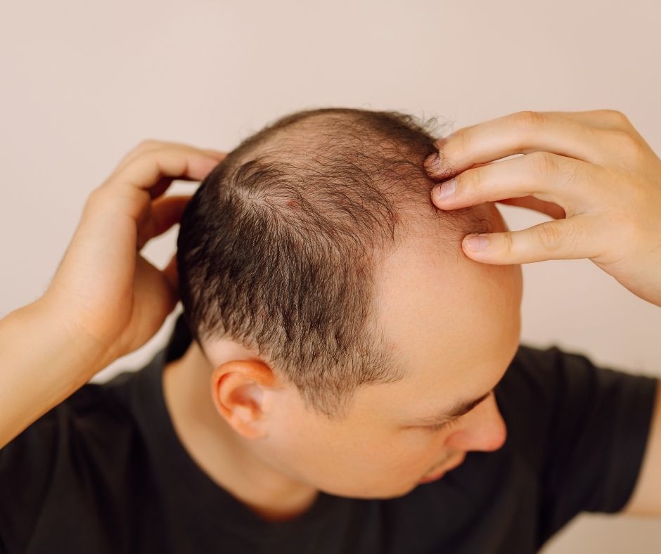 Yüz Asimetrisi Düzeltme: Dolgu ile Simetri