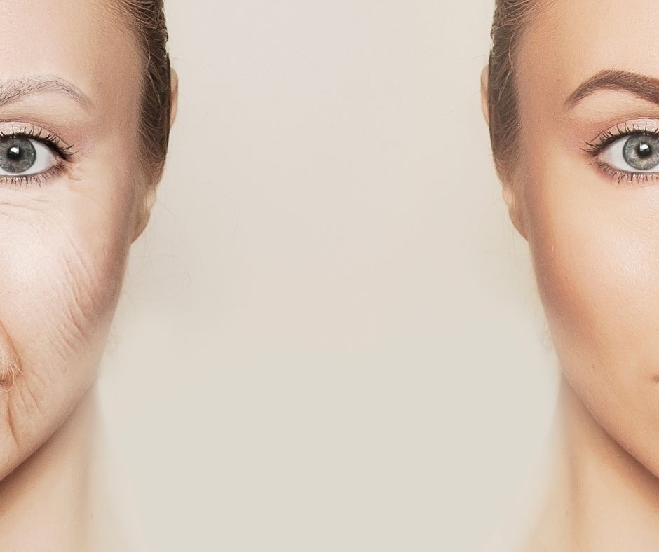 Fox Eye (Kedi Göz) Estetiği: Trend Göz Şekillendirme