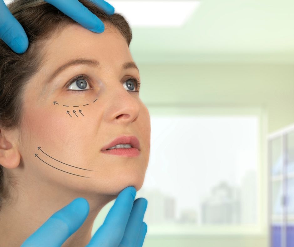 İp Askı (Thread Lift): Cerrahi Olmadan Yüz Germe